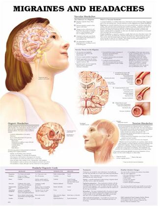 plansze anatomiczne chorób człowieka - Plansza anatomiczna migrena-i-bol-glowy.jpg