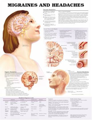 Plansze Anatomiczne - Plansza anatomiczna migrena-i-bol-glowy.jpg